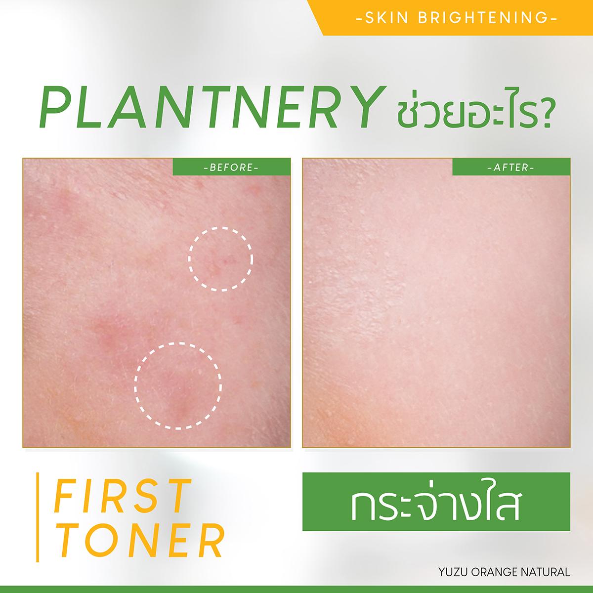 Plantnery Yuzu Orange First Toner 250ml โทนเนอร์ วิตามินซี เข้มข้น จากส้มยูซุ ที่ช่วยลดเลือนผิวหมองคล้ำ ทำให้ผิวดูกระจ่างใสภายใน 7 วัน