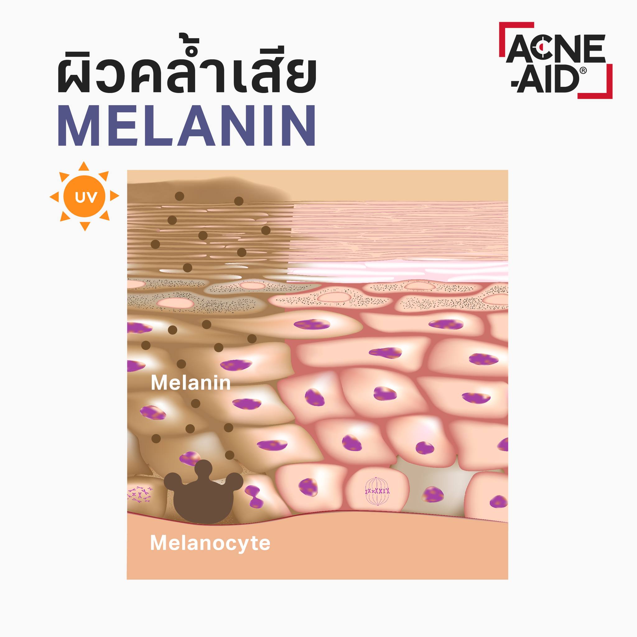 Acne-Aid Scar Care Gel 10 g ลดจุดด่างดำ